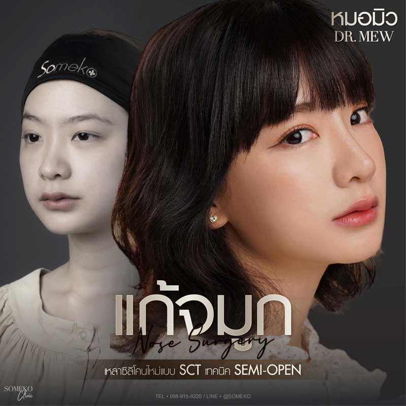 ลีเกดแก้จมูกกับคุณหมอมิว